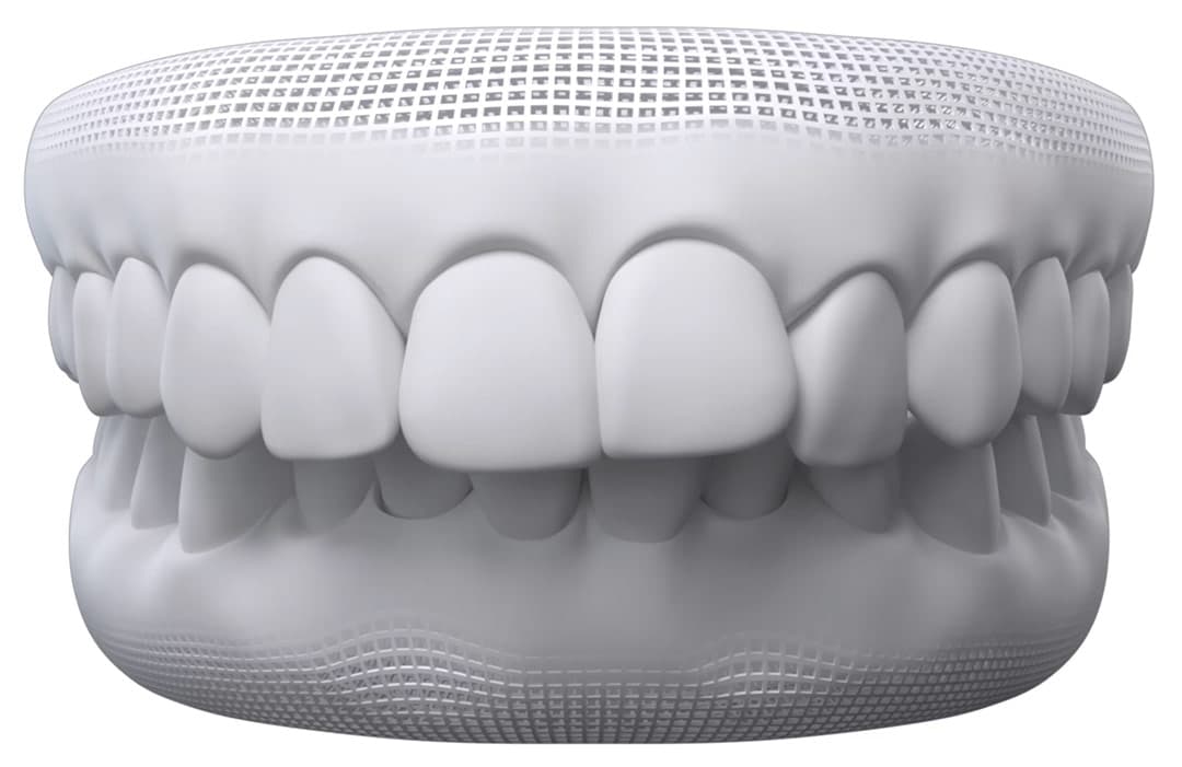 What Are 'Perfect' Straight Teeth? (How Can You Get Them), Byte®