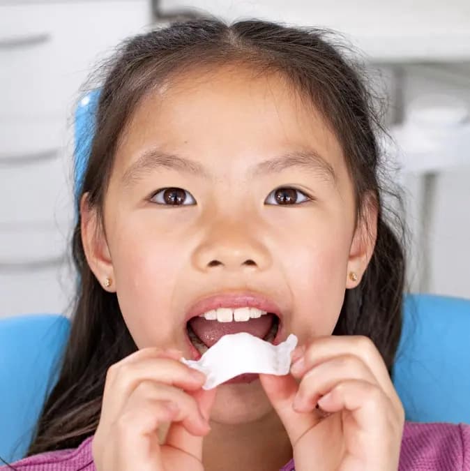 Little girl wearing Invisalign palatal expander